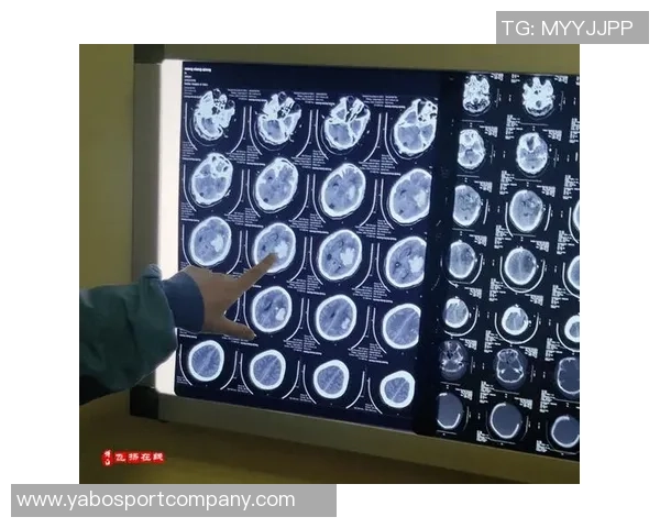 英博官方宣布宋岳成功接受关节镜微创手术恢复顺利无并发症